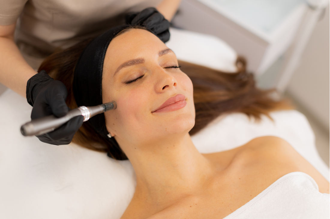 Is Microneedling Worth the Hype?