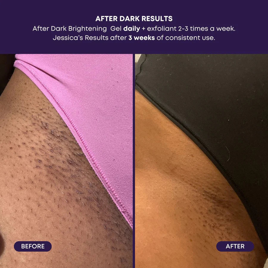 BUSHBALM After Dark Brightening Gel - 50ml