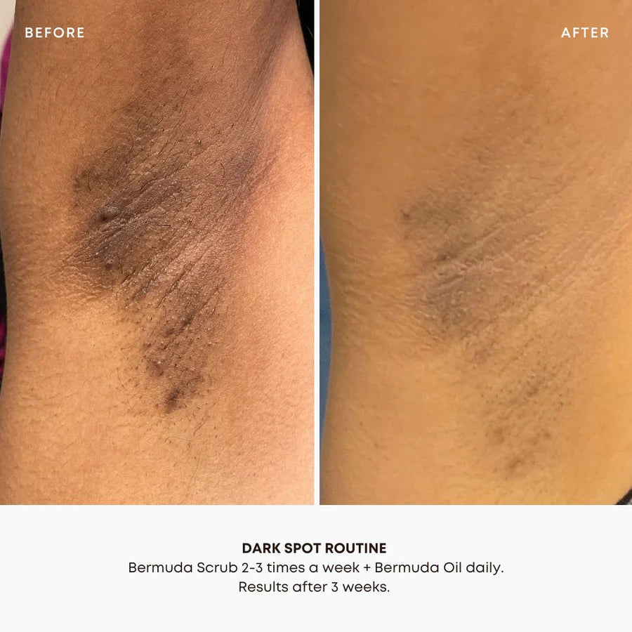 BUSHBALM Bermuda Dark Spot Oil - 30ml