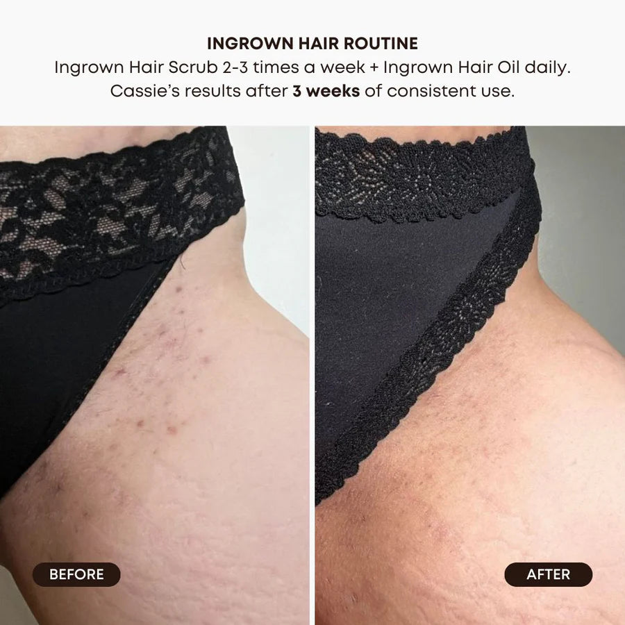 BUSHBALM Watermelon Sugar Ingrown Hair 2 Step Routine