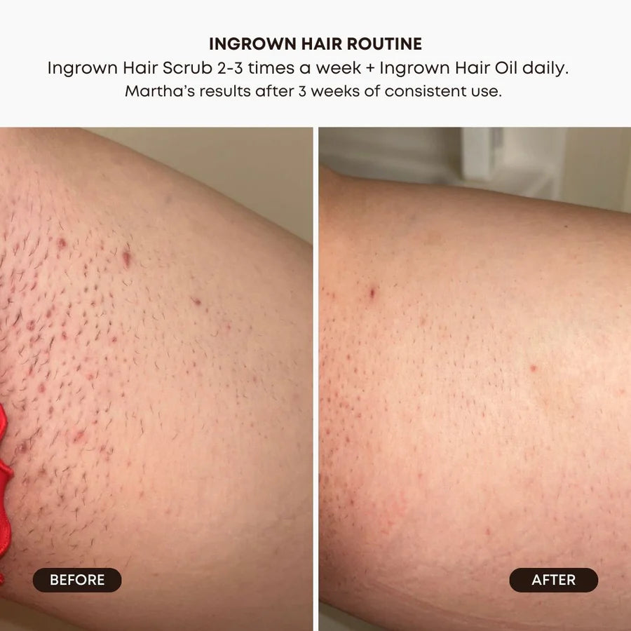 BUSHBALM Watermelon Sugar Ingrown Hair Exfoliating Scrub - 236ml