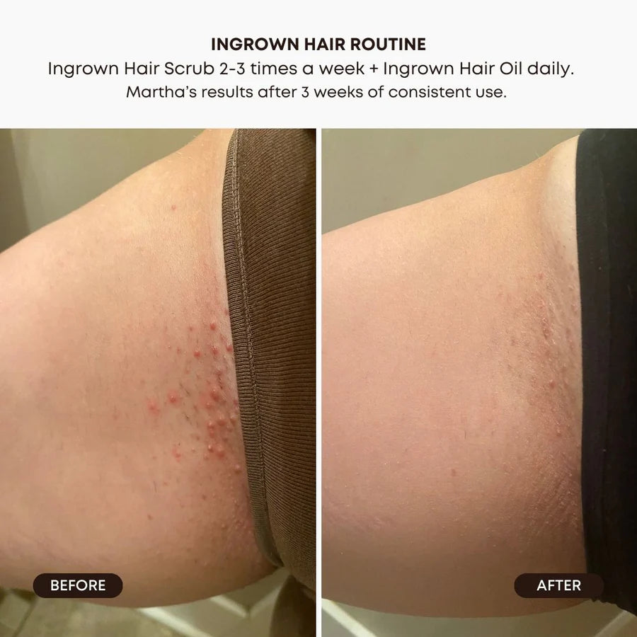 BUSHBALM Watermelon Sugar Ingrown Hair Exfoliating Scrub - 236ml