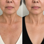 KRX AESTHETICS The Neck Lift Intensive Firming Cream - 50ml